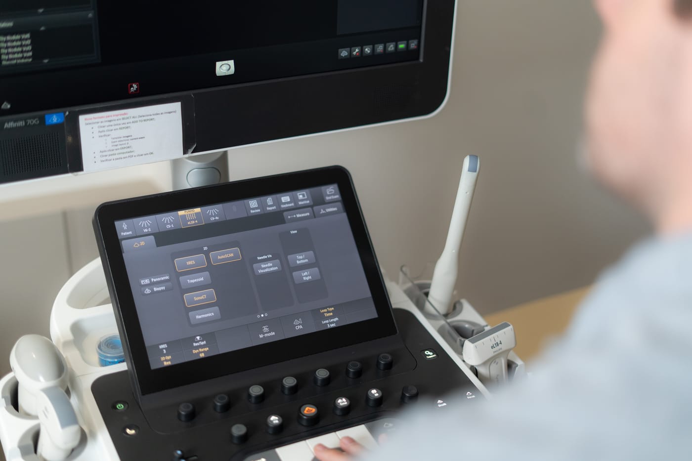 Aparelho de ultrassom do consultório do Dr. Fernando Hehn, com o painel de controle e a tela